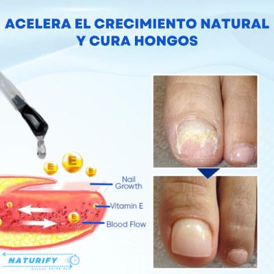 NailEssence™ 2X1 - Serum de Crecimiento y Reparación de Uñas