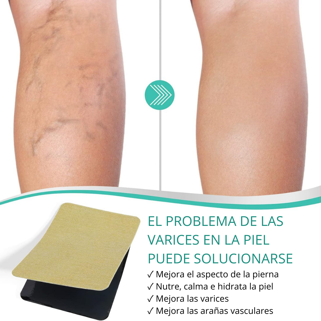 VEINS PARCH ™: ELIMINA VARICES CON FÓRMULA NATURAL🌿 RESULTADOS EN 10 DÍAS👨⚕️ OFERTA ESPECIAL 2X1🎁😵