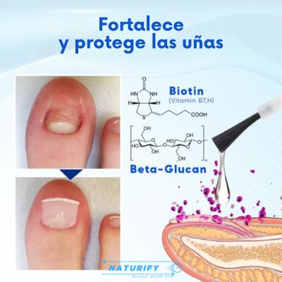 NailEssence™ 2X1 - Serum de Crecimiento y Reparación de Uñas