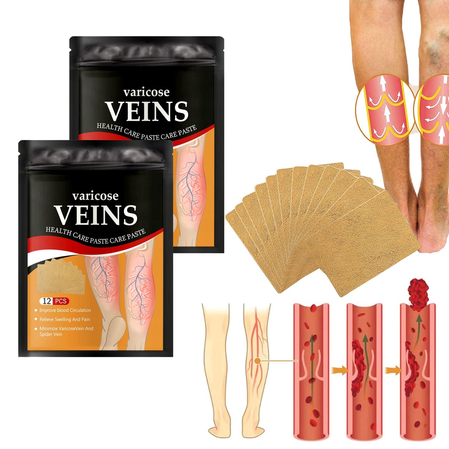 VEINS PARCH ™: ELIMINA VARICES CON FÓRMULA NATURAL🌿 RESULTADOS EN 10 DÍAS👨⚕️ OFERTA ESPECIAL 2X1🎁😵