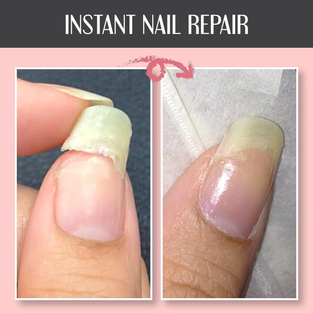 Gel protector reparador de uñas