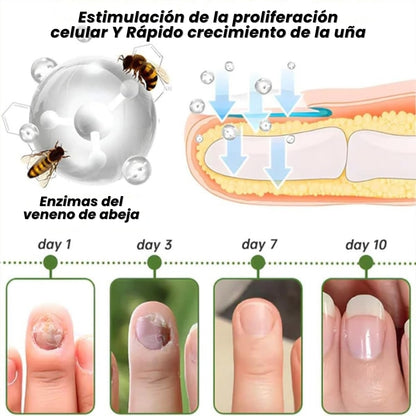 OFERTA ESPECIAL 2X1🎁GERMX® Gotas Anti Hongos Para pies y manos