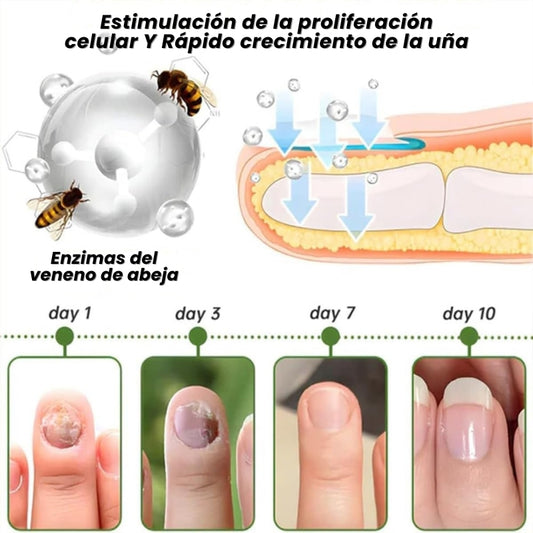 OFERTA ESPECIAL 2X1🎁GERMX® Gotas Anti Hongos Para pies y manos