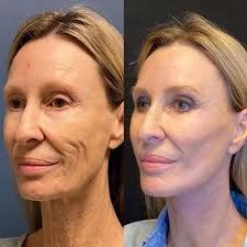 SkinRevive™ - Resultados Visibles y Duraderos en ⛱️SOLO 10 DÍAS 😵🤩 OFERTA IMPERDIBLE 2X1🌞