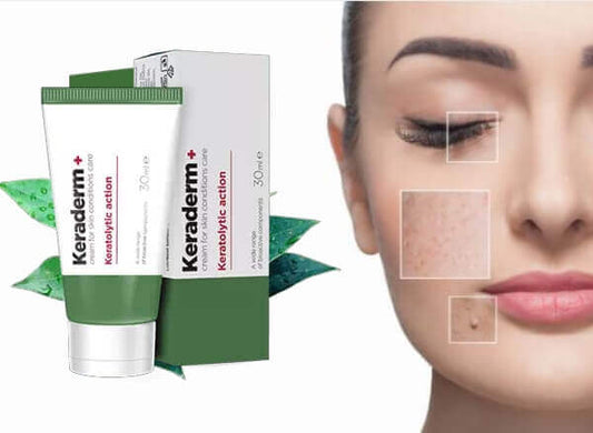 Keraderm™ : Crema para Psoriasis Hidratante y Antihongos para Manos y Pies