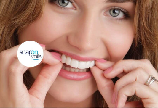 ¡OFERTA ESPECIAL 3X1 🤯SOLO POR ESTA SEMANA!🎁Carillas Dentales SnapOnSmile®- ORIGINAL